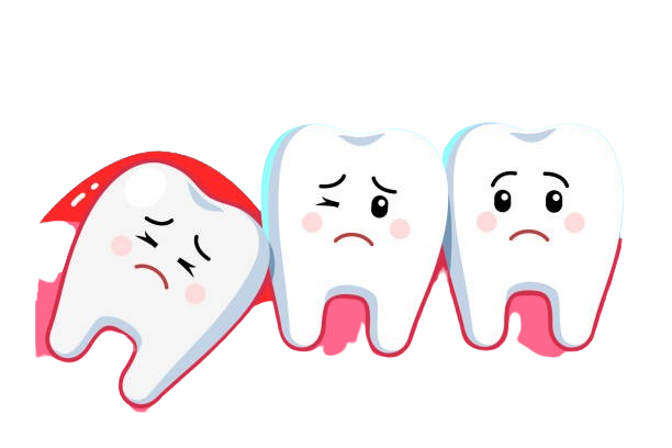 Wisdom Teeth Removal